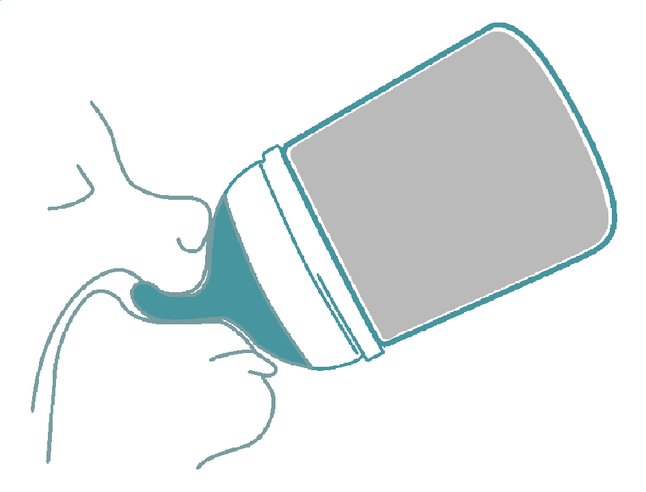 Suavinex Zuigfles Zerø.Zerø Variabele flow 180 ml